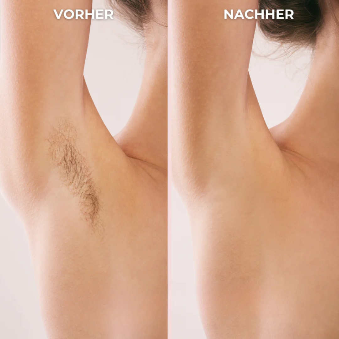 BikiniTrim Pro - für eine sanfte & mühelose Rasur