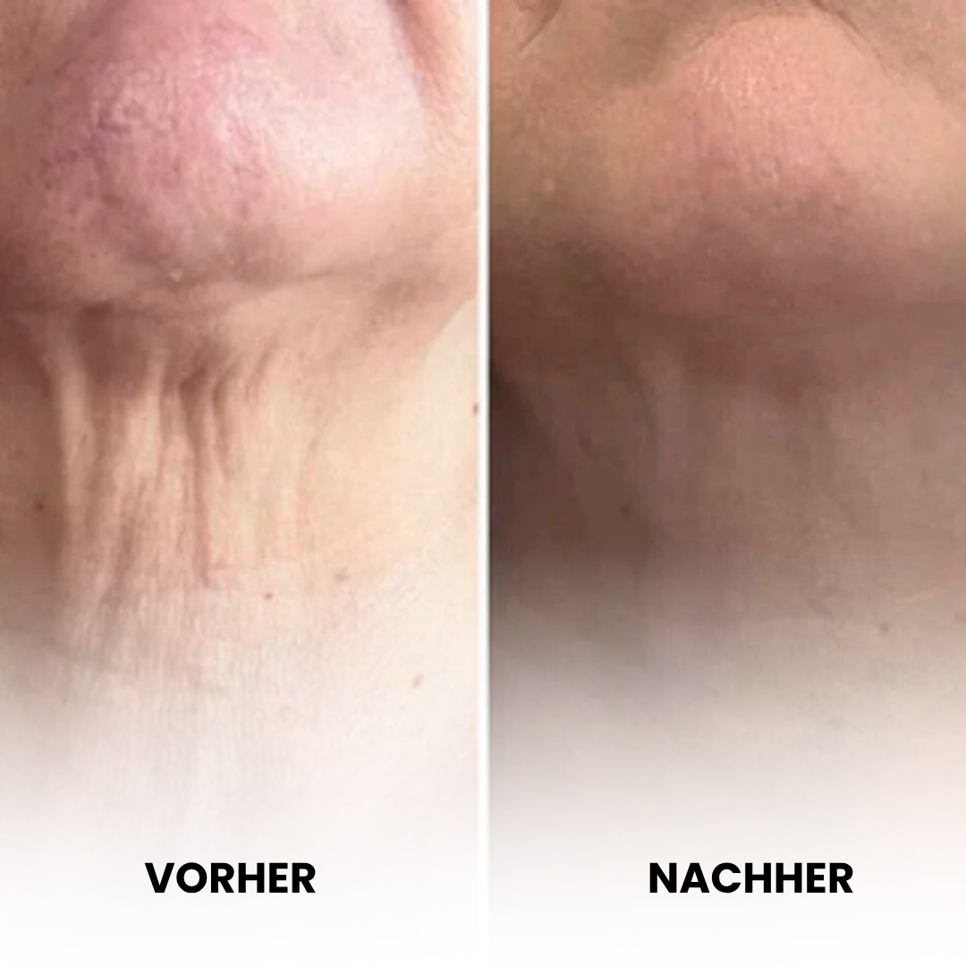 PureLift - Straffende Anti-Aging-Creme