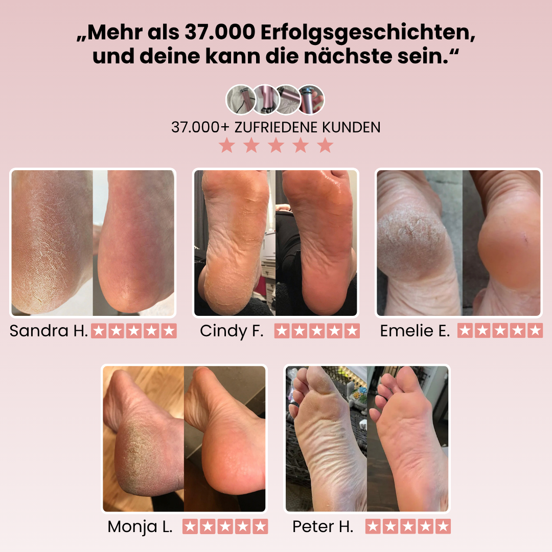 Luva Pro