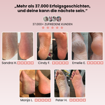 Luva Pro