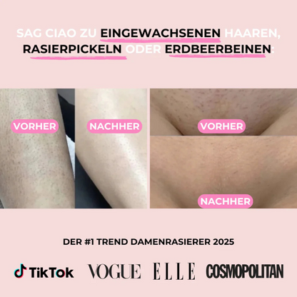 BikiniTrim Pro - für eine sanfte & mühelose Rasur